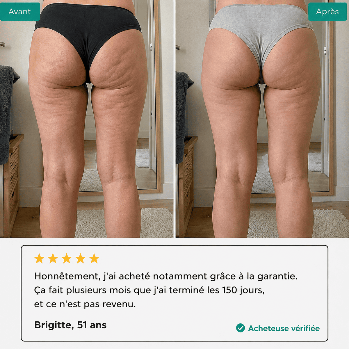 Lynae - Drainant Lymphatique - Cellulite