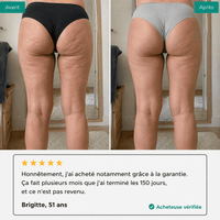 Lynae - Drainant Lymphatique - Cellulite — vue 8