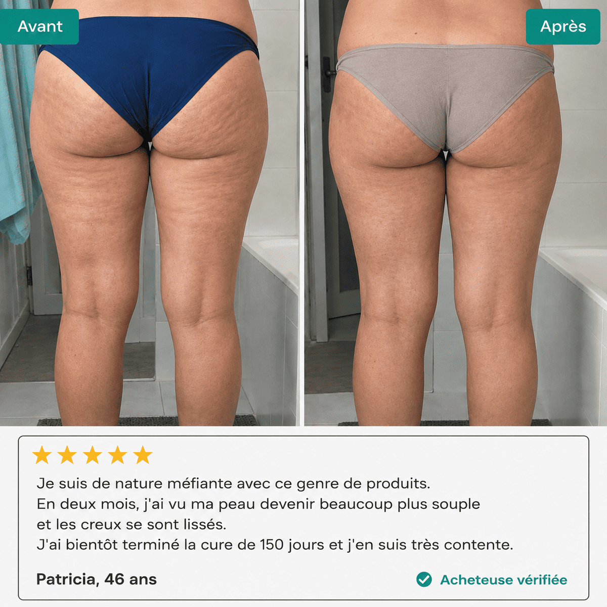 Lynae - Drainant Lymphatique - Cellulite