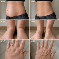 Lynae - Drainant Lymphatique - Ménopause — vue 2