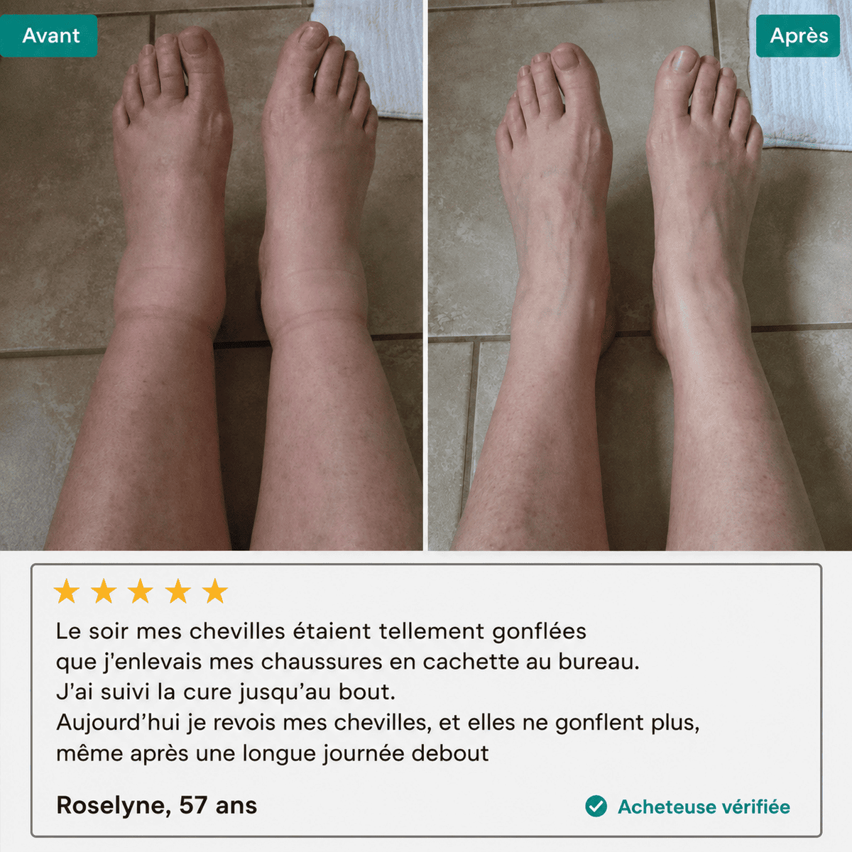 Lynae - Drainant Lymphatique - Ménopause