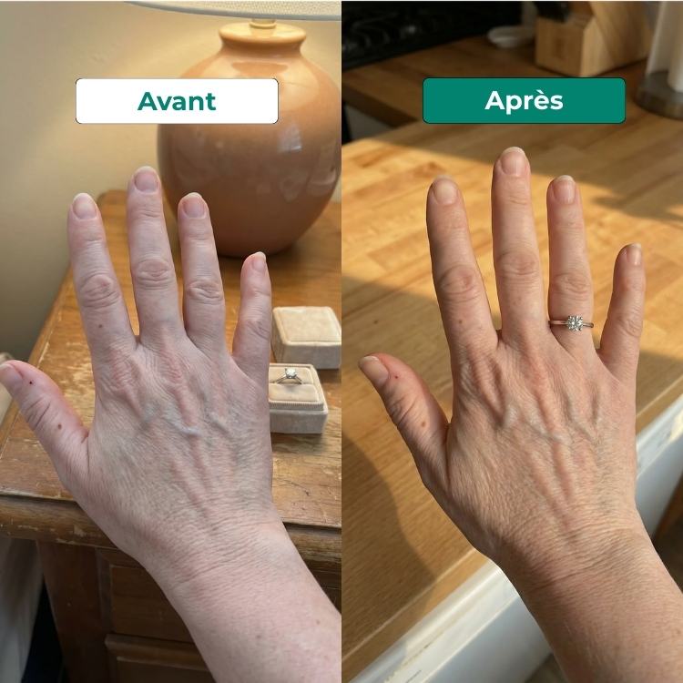 Frêne piquant
